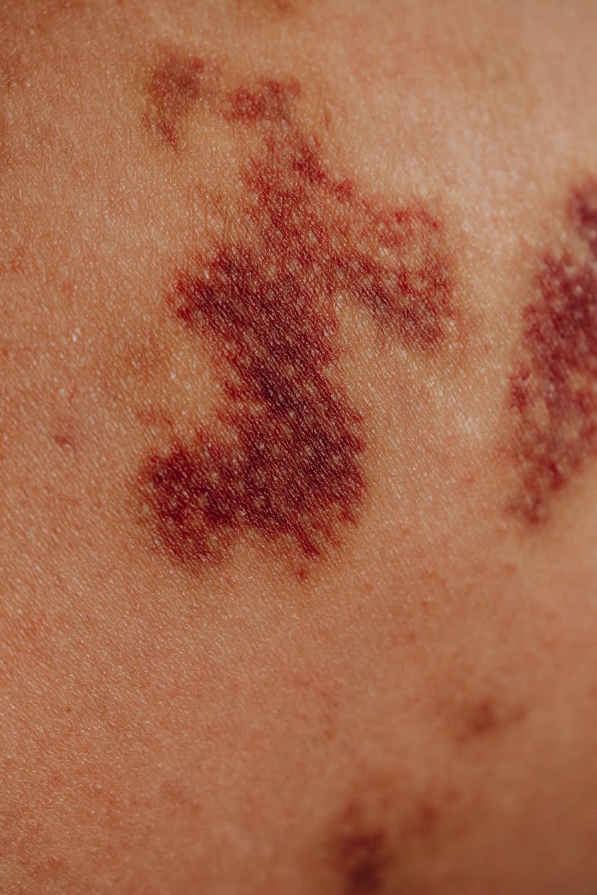 Can an App Spot Skin Cancer? Exploring the Role of AI in Dermatology