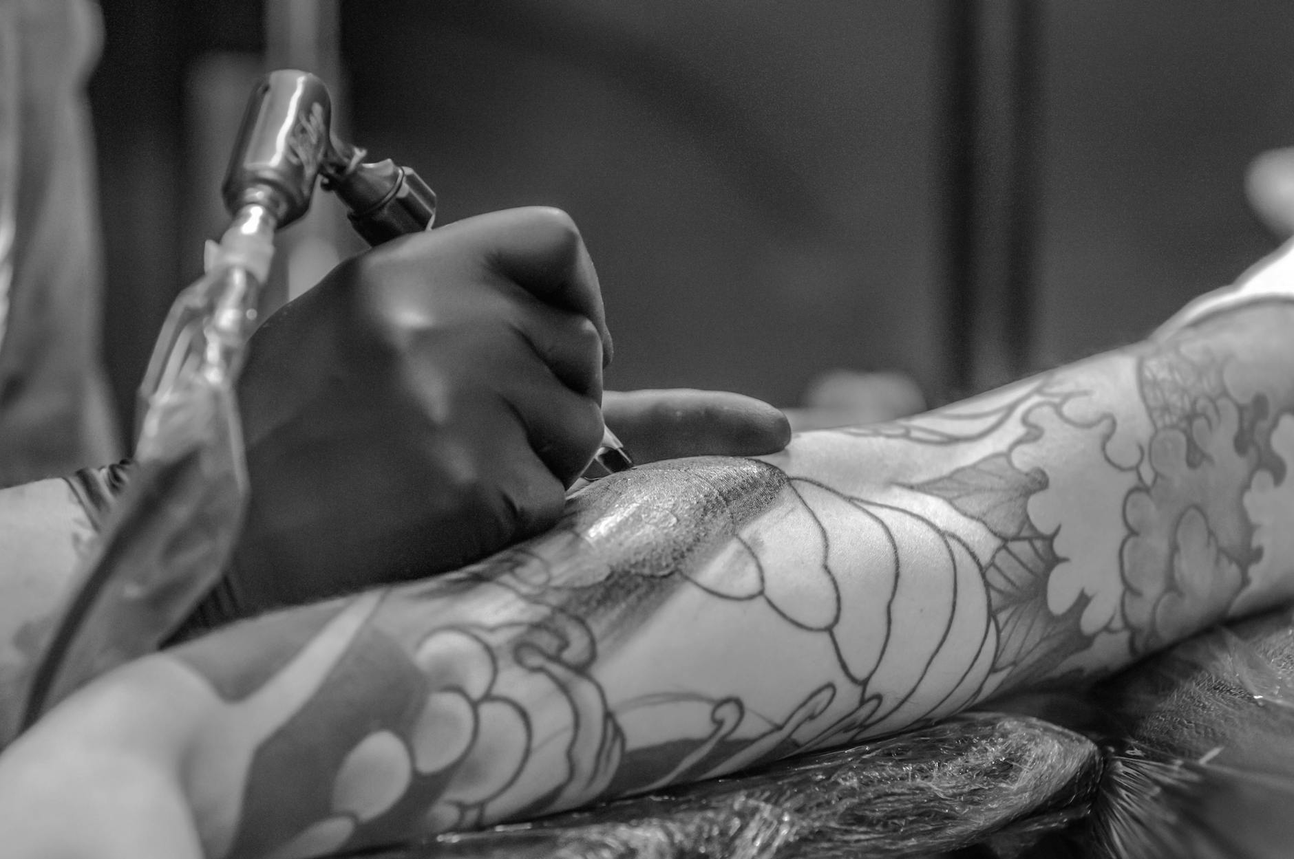 5 Key Benefits of Choosing Surgical Tattoo Removal