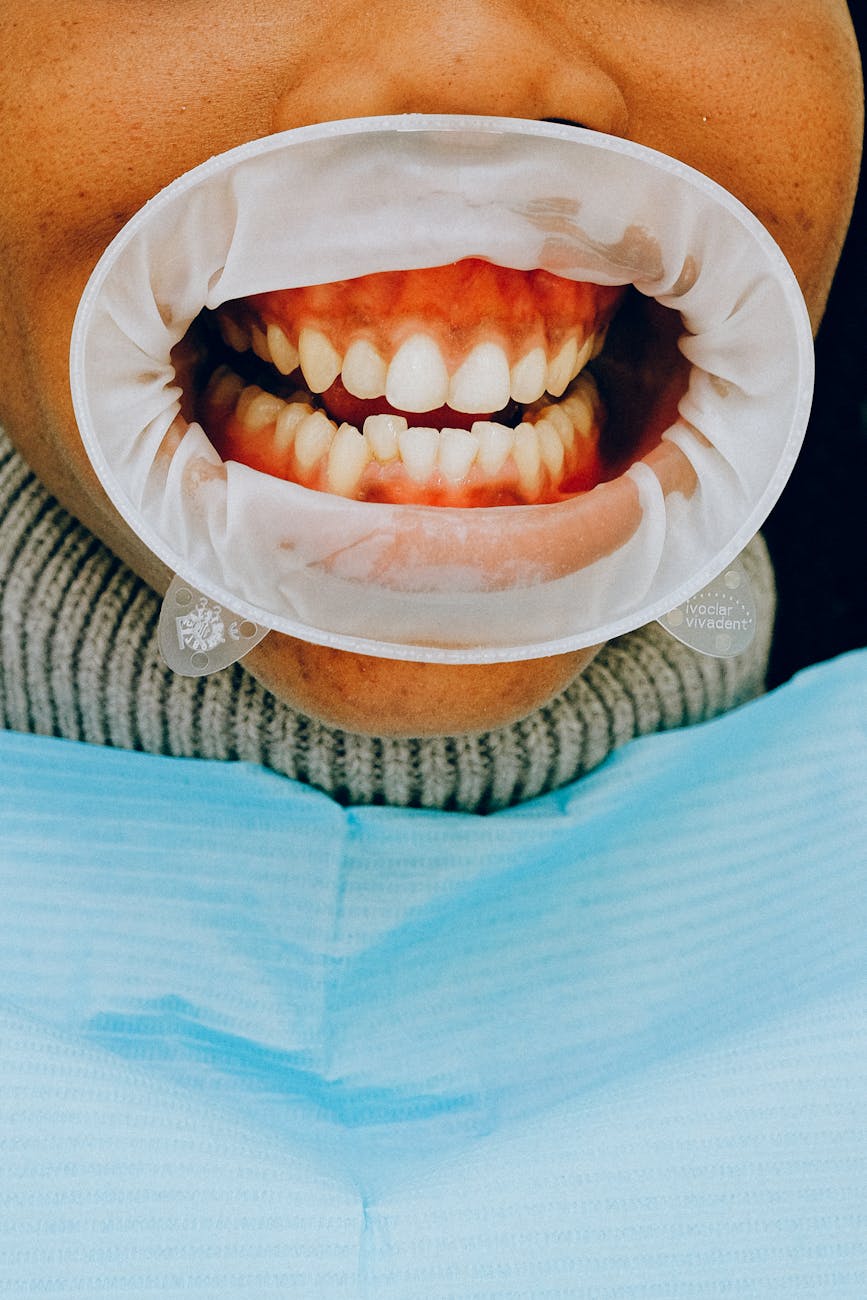 How Gum Disease Affects Children in Brooklyn and What Parents Can Do