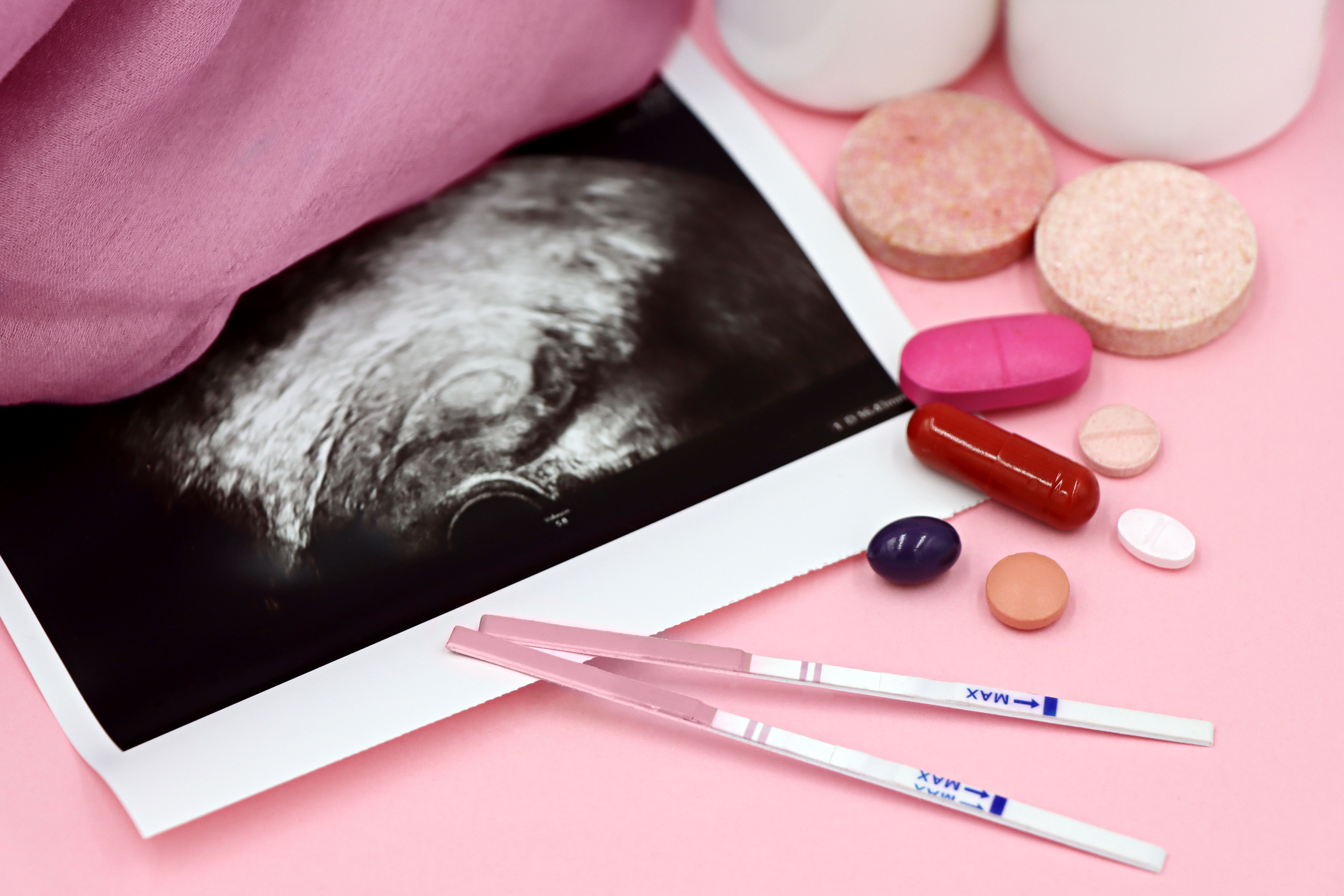 Do IVF Babies Come Early? What Research Says About IVF and Premature Birth